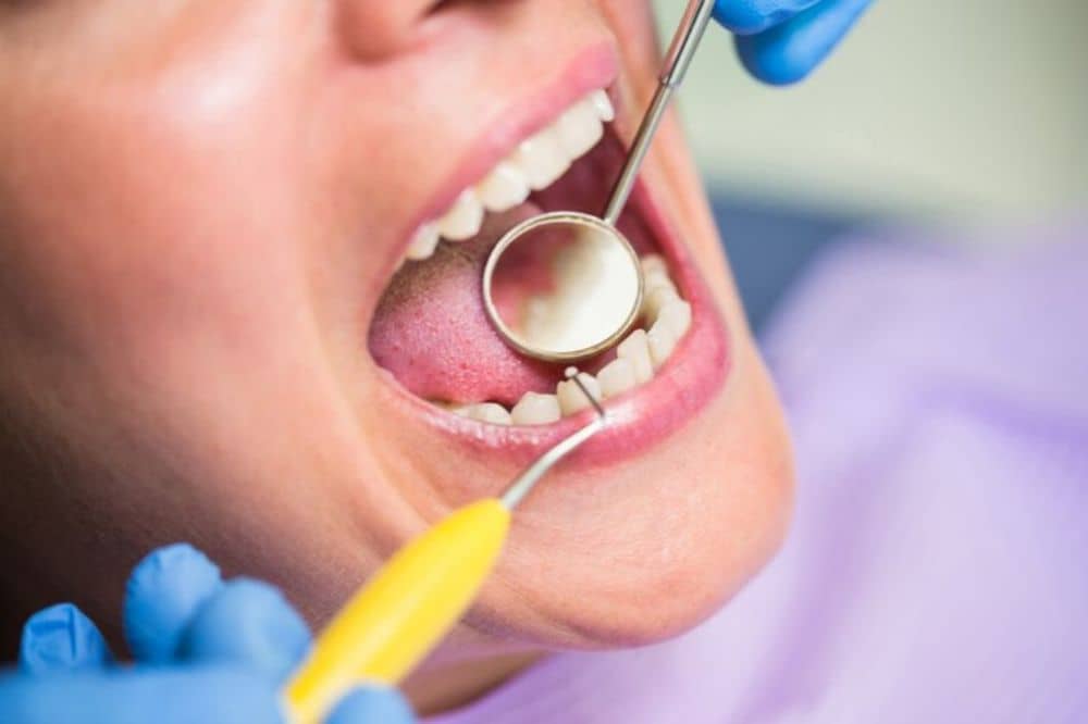 dentist-examining-female-patient-teeth